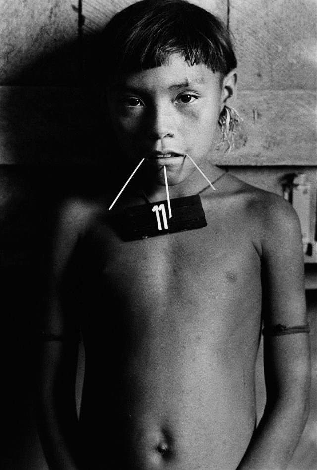 Surucucus, Roraima, 1983. Foto de Claudia Andujar da série "Marcados",  que integra a exposição "Claudia Andujar: A luta Yanomami"